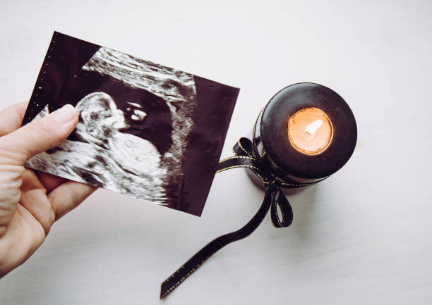Fertility Spells 5 candle fertility spell